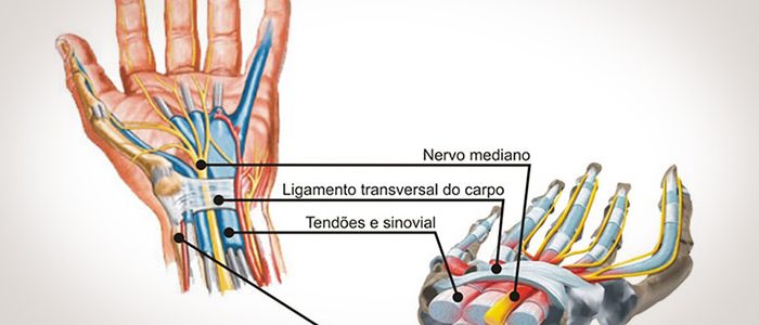 Síndrome do Túnel do Carpo